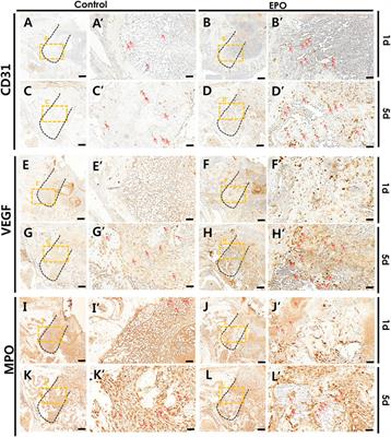 Effects of erythropoietin on osteoblast in the tooth extraction socket in mice periodontitis model